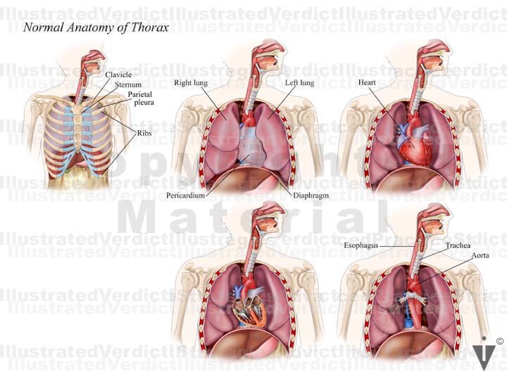 Stock Lungs: Normal Anatomy — Illustrated Verdict