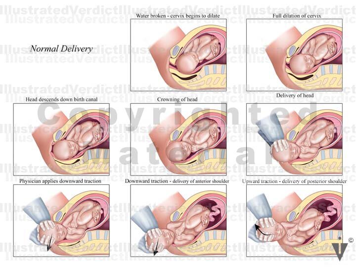 Stock Pregnancy / Delivery: Normal Delivery — Illustrated Verdict