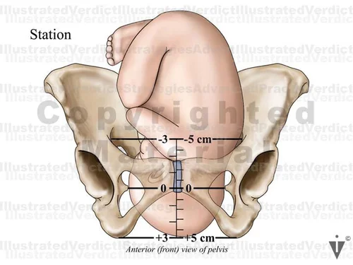 Stock Pregnancy / Delivery: Normal Delivery — Illustrated Verdict