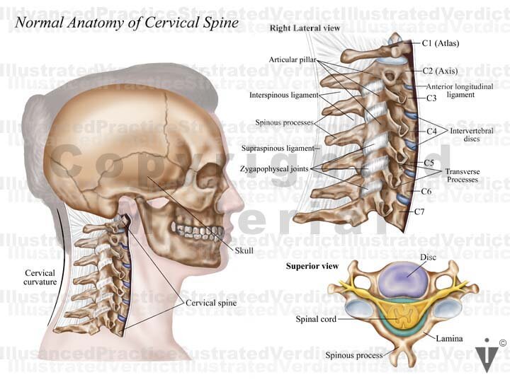 Stock Spine: Cervical Spine — Illustrated Verdict