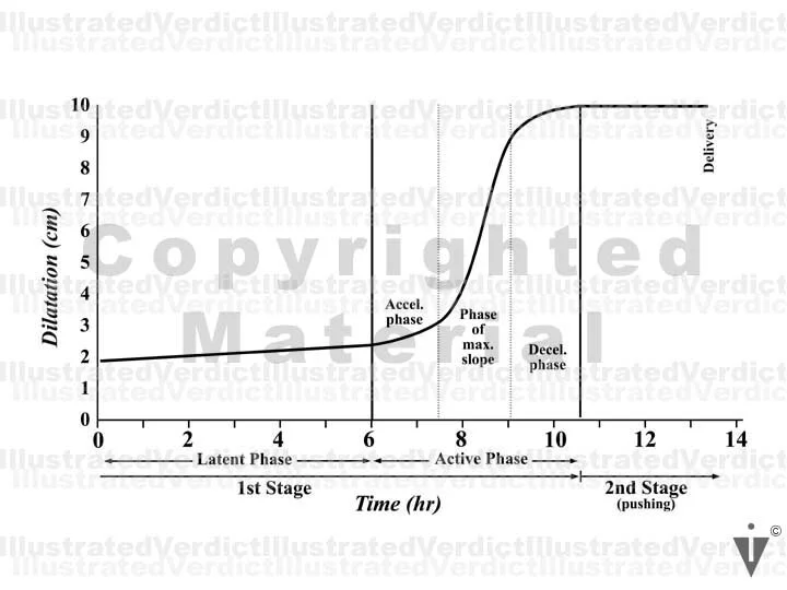 Stock Pregnancy / Delivery: Charts / Graphs / Labor Curves ...