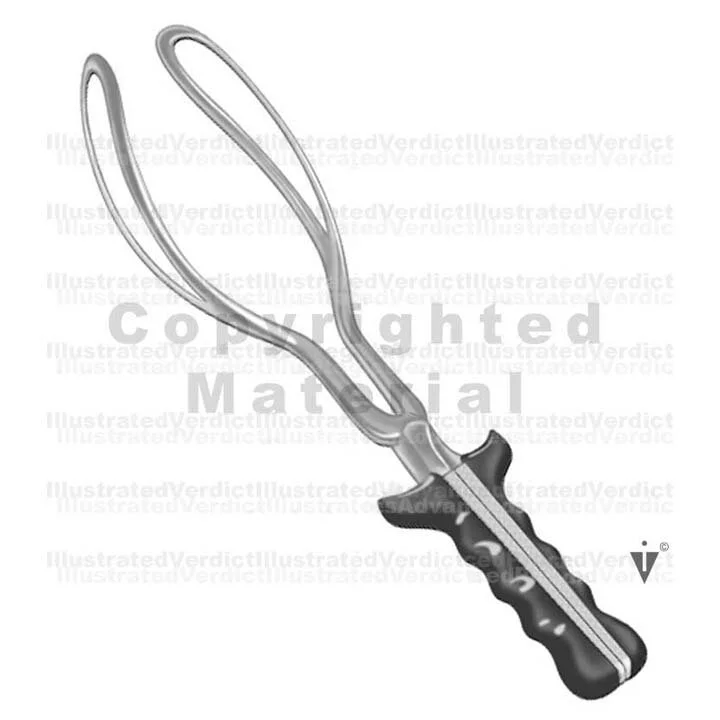 Stock Pregnancy / Delivery Vacuum / Forceps — Illustrated Verdict