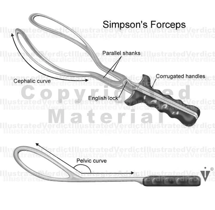 Stock Pregnancy / Delivery: Vacuum / Forceps — Illustrated ...