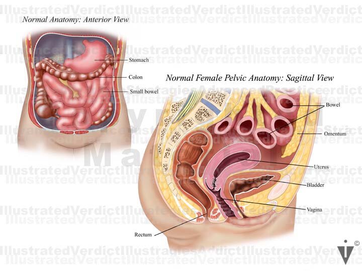 Stock Female Pelvis: Normal Anatomy — Illustrated Verdict