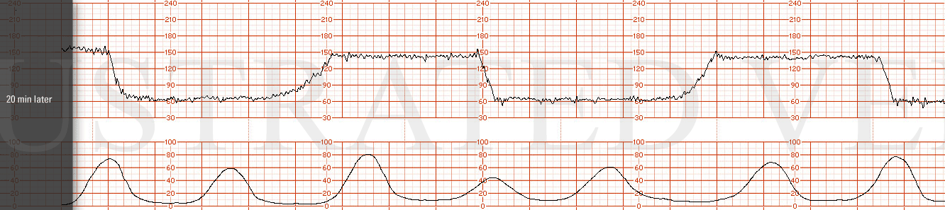 STRIP 54 1. Add deeper decelerations with progression getting worse