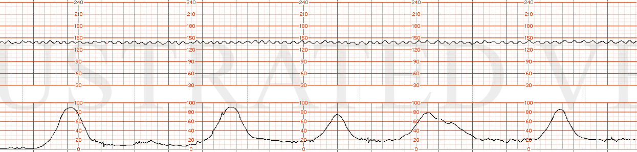 STRIP 68 1. Sinusoidal tracing