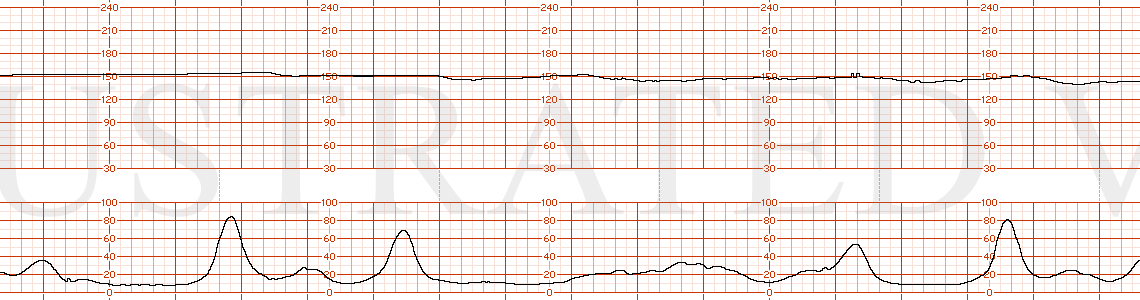 STRIP 196 1. Minimal variability
