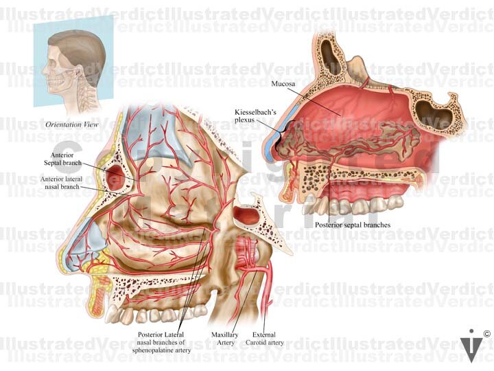 Stock Nose / Sinus: Normal Anatomy — Illustrated Verdict