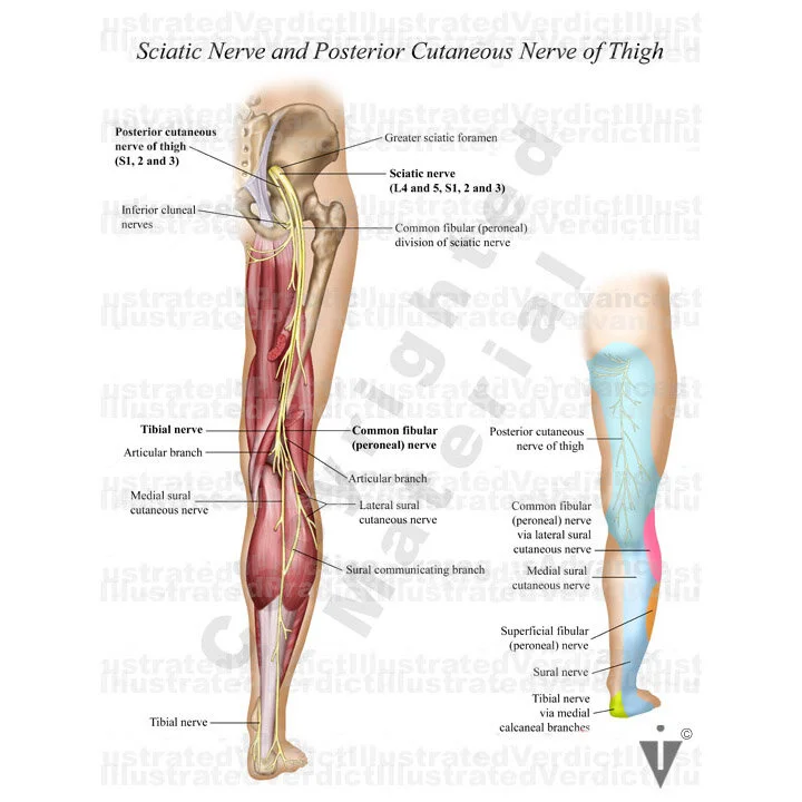 Stock Female Pelvis: Nerves — Illustrated Verdict