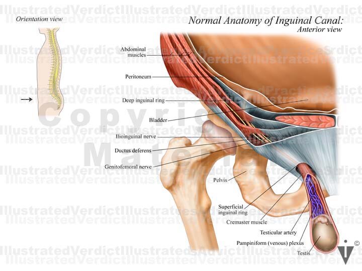 Inguinal Hernias – Anatomy QA