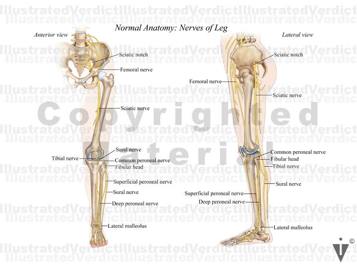 CASE AT A GLANCE: Sciatic Nerve Injury w/ Hip Replacement — Illustrated