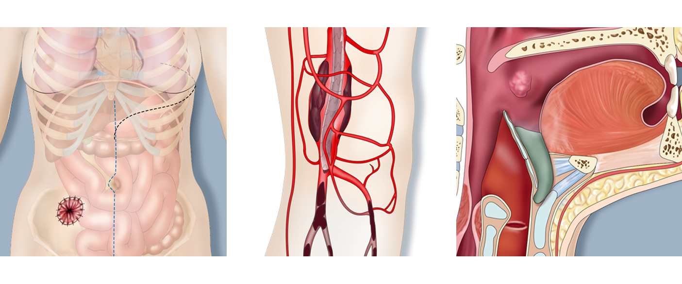 CASE AT A GLANCE - Sept 2020  