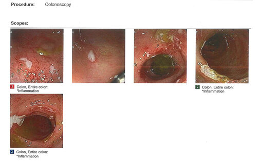 MITTY_COLONOSCOPY_IMAGES_AND_REPORTS-5_2.jpg