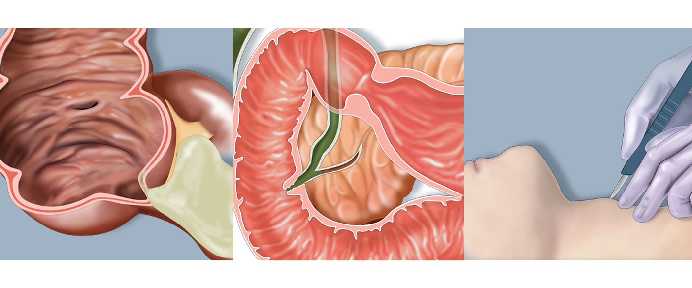 CASE AT A GLANCE - Oct 2020