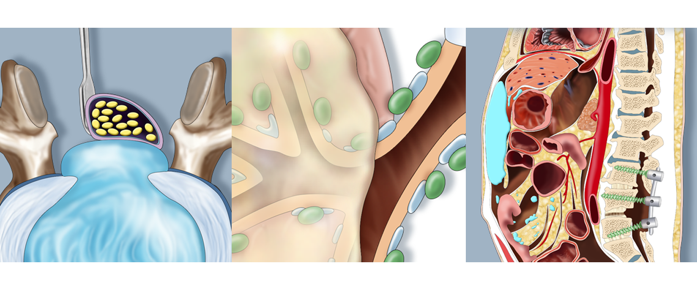 CASE AT A GLANCE - April 2021