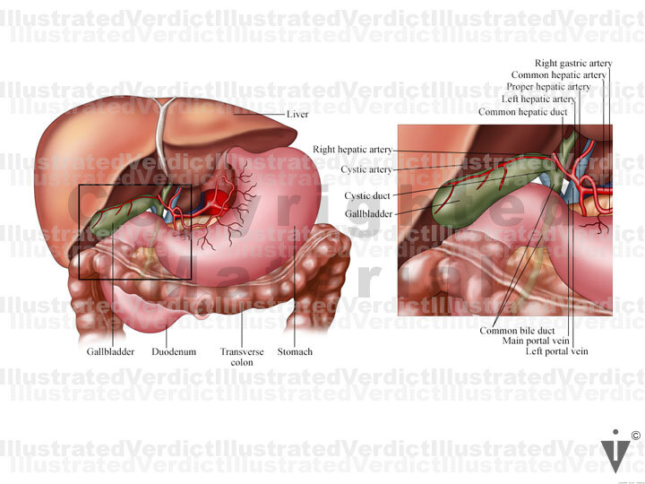 Normal Gallbladder Real Stock Gallbladder: Normal Anatomy — Illustrated Verdict