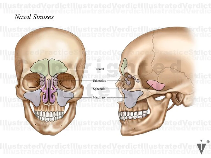 CASE AT A GLANCE: Ethmoidectomy with Removal of Polyps — Illustrated ...