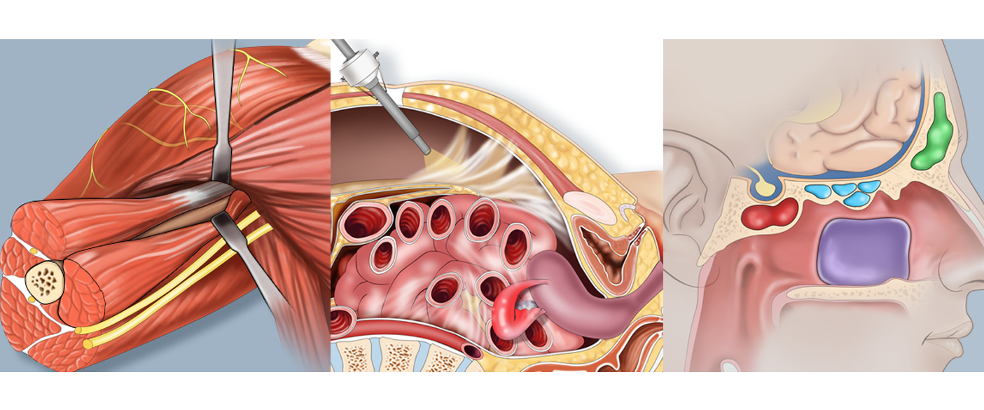 CASE AT A GLANCE - Feb 2022