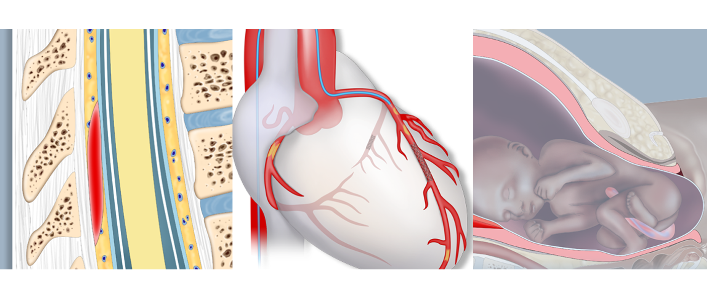 CASE AT A GLANCE - July 2022