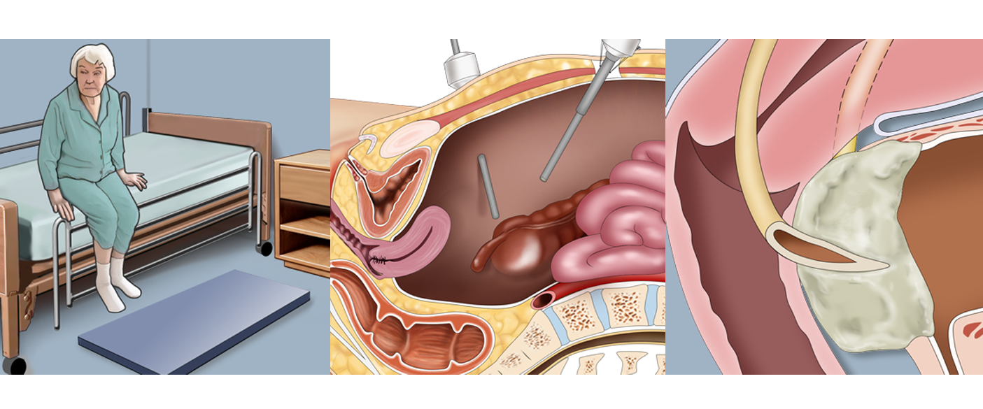 CASE AT A GLANCE - March 2025