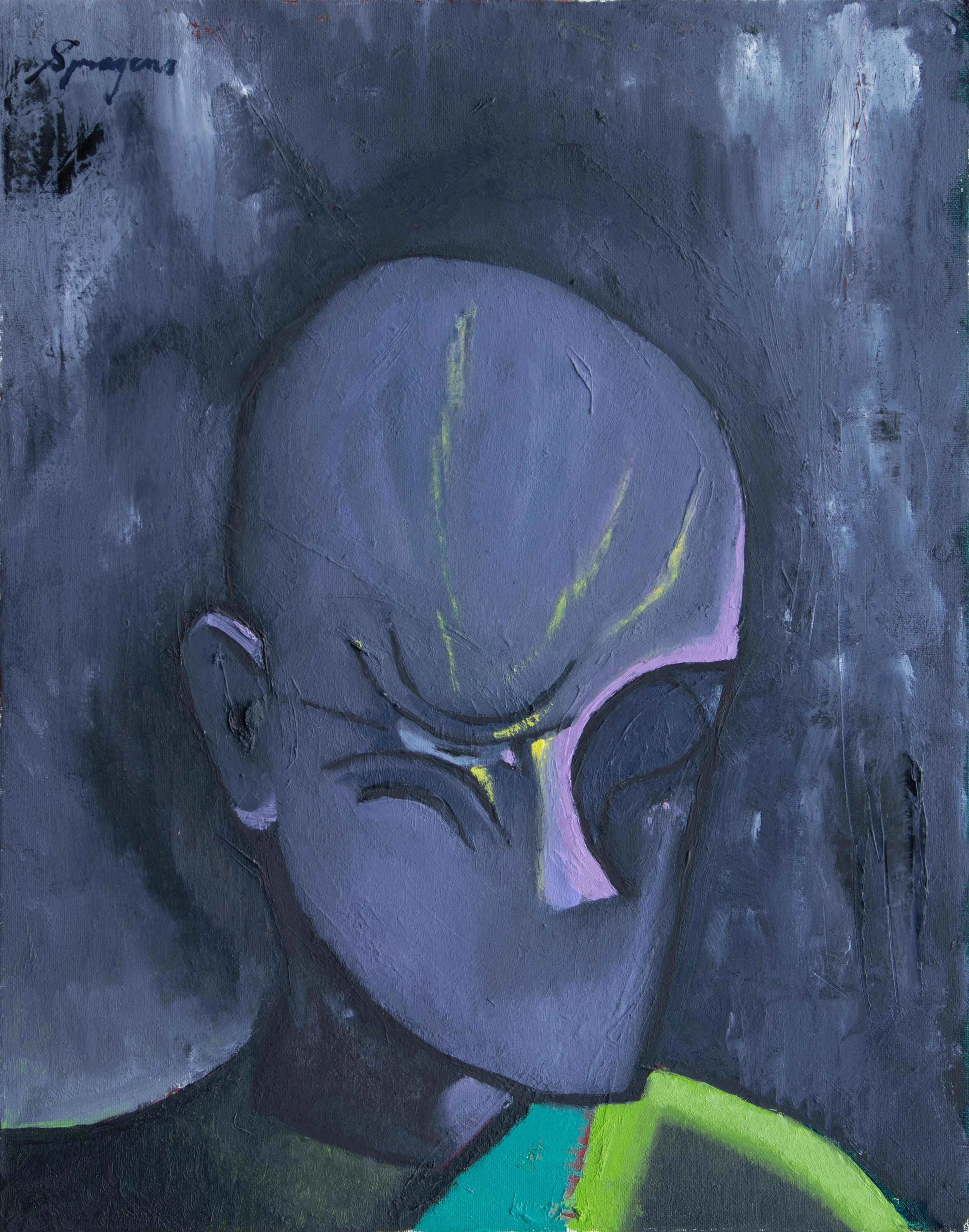 Alex Spragens, Eye Twitch