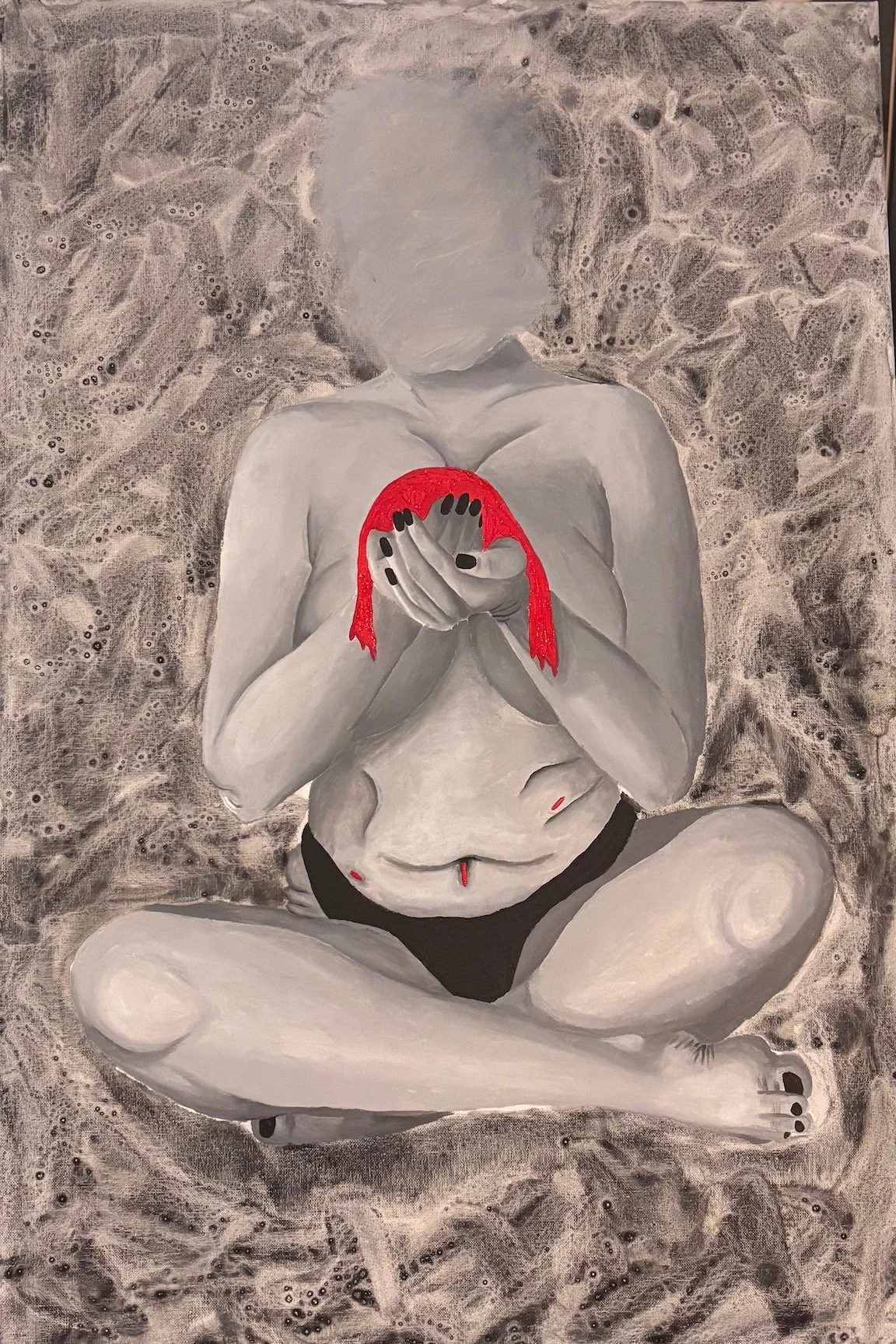 Allison Carol Schmocker, Post-Op