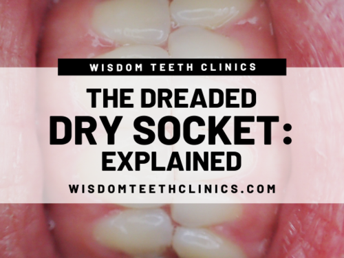 Dry socket teeth