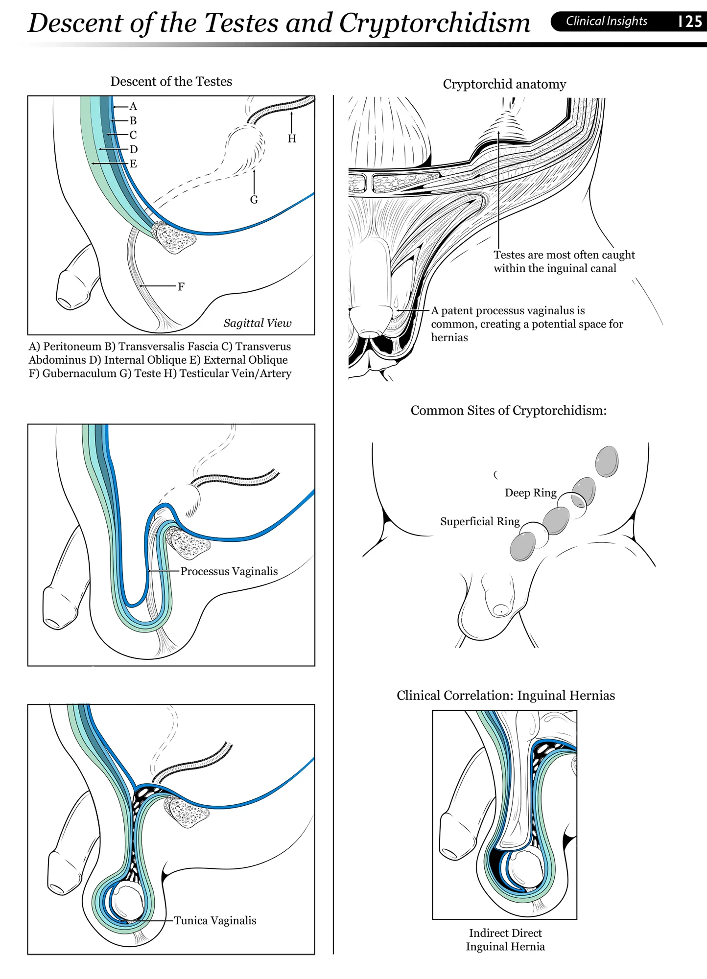 Inguinal2.jpg
