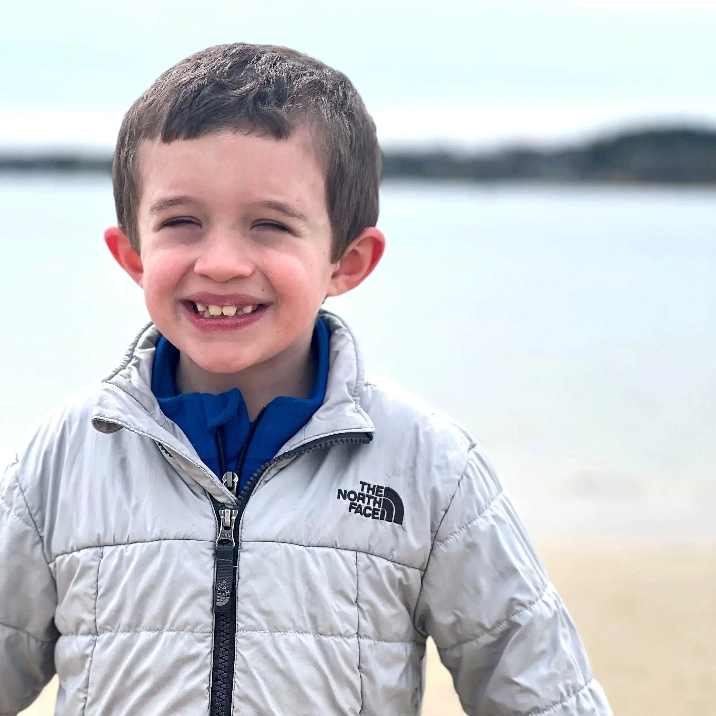 Beautiful Faces of CFC Syndrome