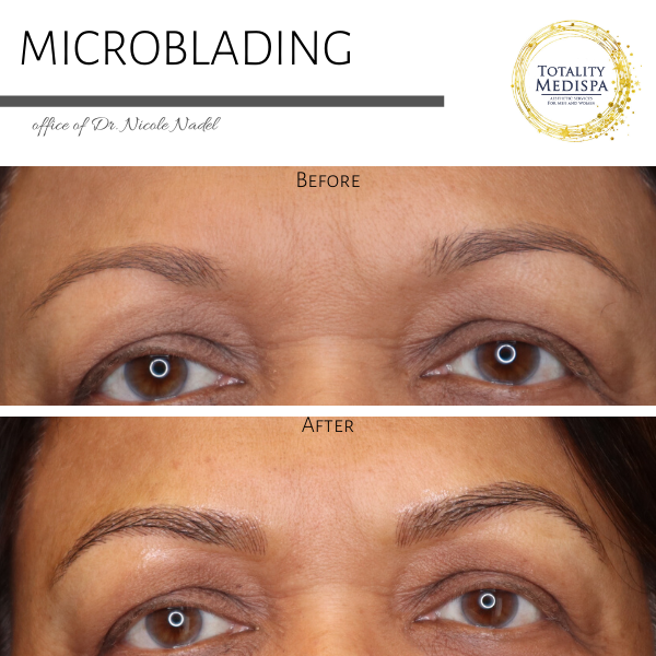 Microblading — Totality Medispa