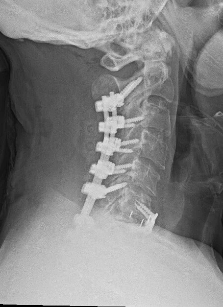 Stewart Post Lat.jpg