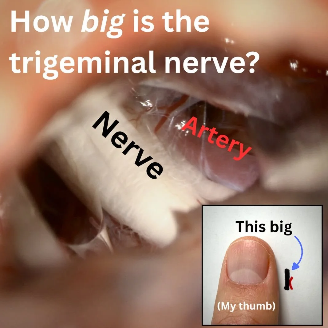 I often post these high-resolution images of the trigeminal nerve, but how zoomed in are they? 

Although the trigeminal nerve is relatively large compared to other cranial nerves, it&rsquo;s still only 2-3 millimeters wide. And the arteries and vein
