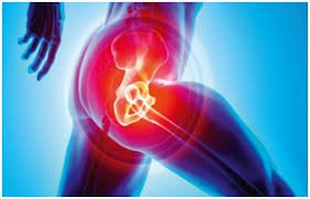 Hip Pain