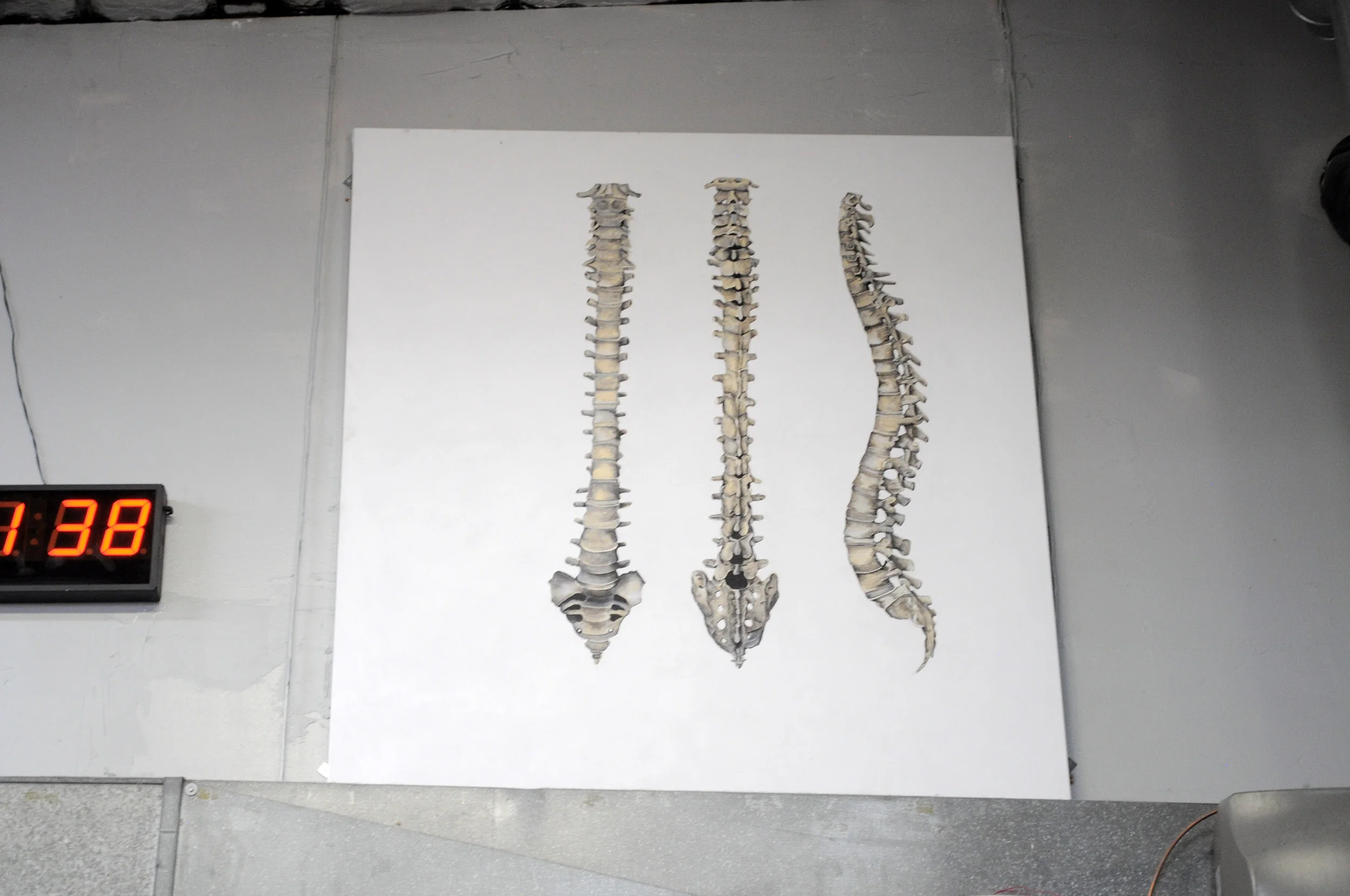 Spinal Views at Fiternal.jpg