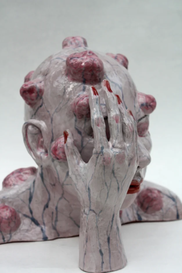  Lump Trauma 2013 Ceramic   