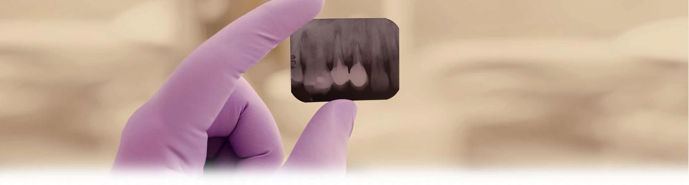 tooth_xray.jpg