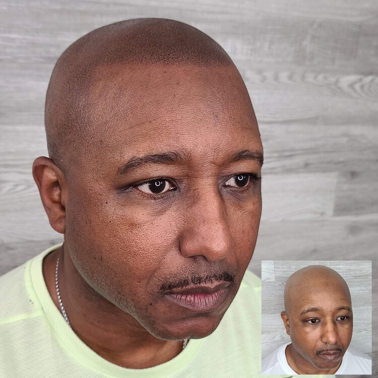 before and after being bald.jpg