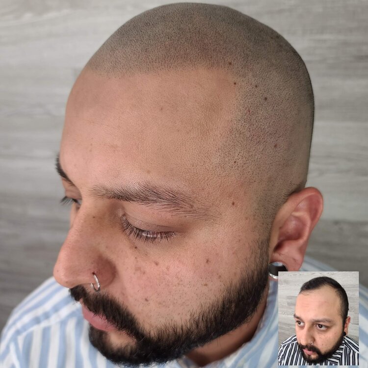 scalp co hair before and after.jpg