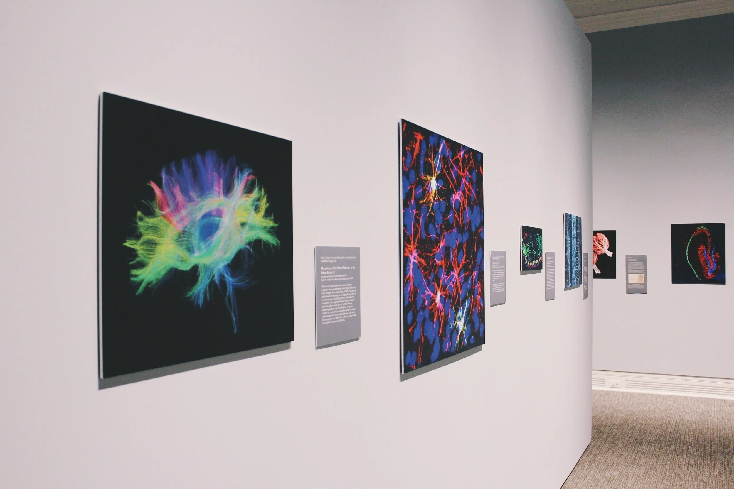 Creativity and the Brain