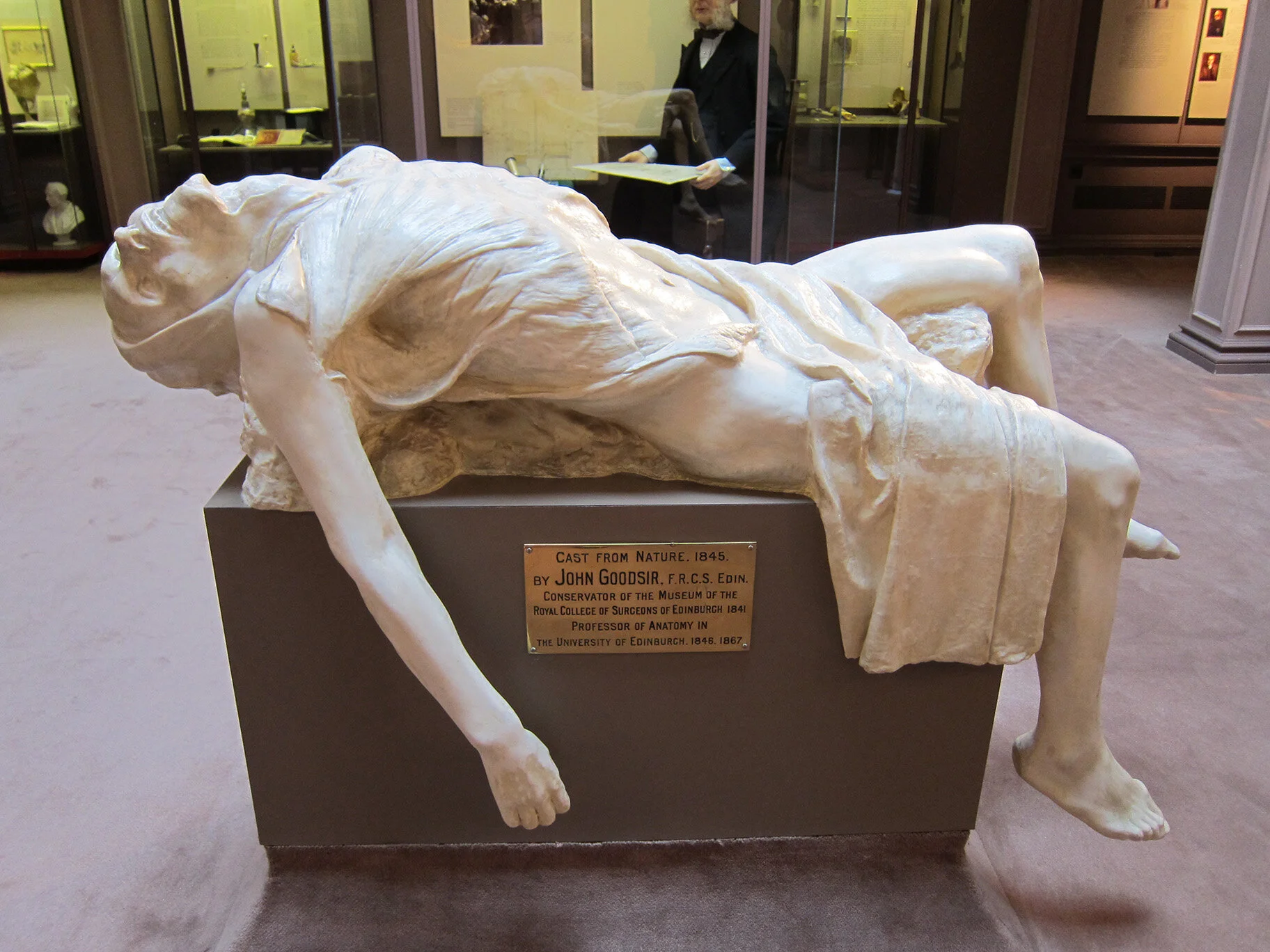 1 RoyalCollSurgeons Fibreglass.jpg