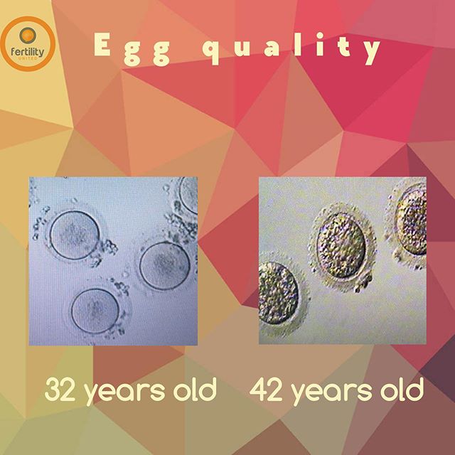 Ladies, egg quality declines as we age! Not all markers of egg quality can be seen microscopically. In fact, most egg abnormalities are internal and cannot be detected visually.  Freeze your eggs while they are at their greatest potential and preserv