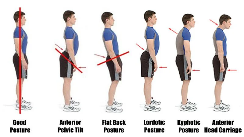 5 Types of Posture (and How to Fix Them)