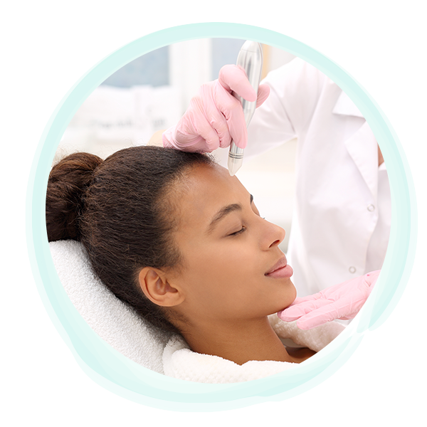 microneedling.png