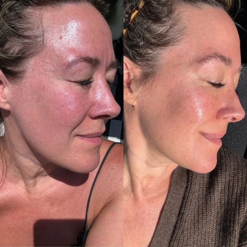 If You’re Over 40 And Your Whole Goal Is Glass Skin, These Are The 9 Things That Actually Work.