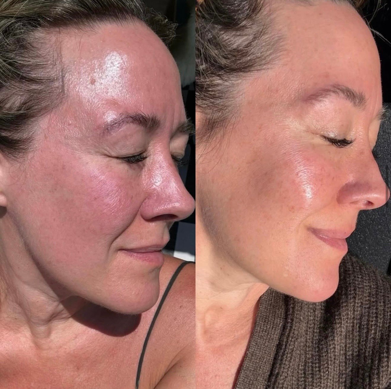 There are 3 products you&rsquo;re not using that are making the biggest difference in our post-40 skin. Including this near-magic home peel that gives you baby soft skin with zero downtime. 
⠀⠀⠀⠀⠀⠀⠀⠀⠀
Link in bio. 
⠀⠀⠀⠀⠀⠀⠀⠀⠀
#LetsTalkCandidly
🔗: htt