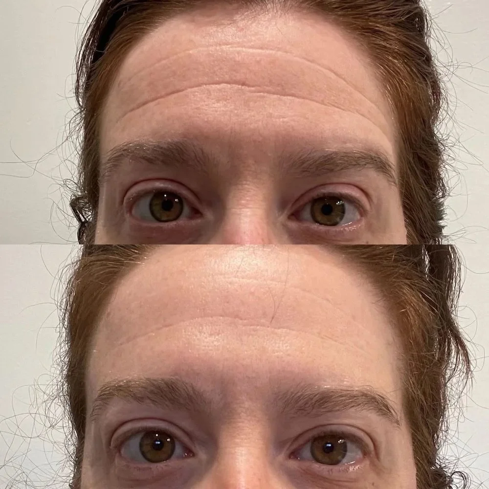 There are 8 products to try to make your face look markedly and near instantly younger&mdash;and they are NOT Botox of filler. Because we&rsquo;re scared of them. 

Link on bio. 

#LetsTalkCandidly
Via @thecandidly
🔗: https://www.thecandidly.com/art