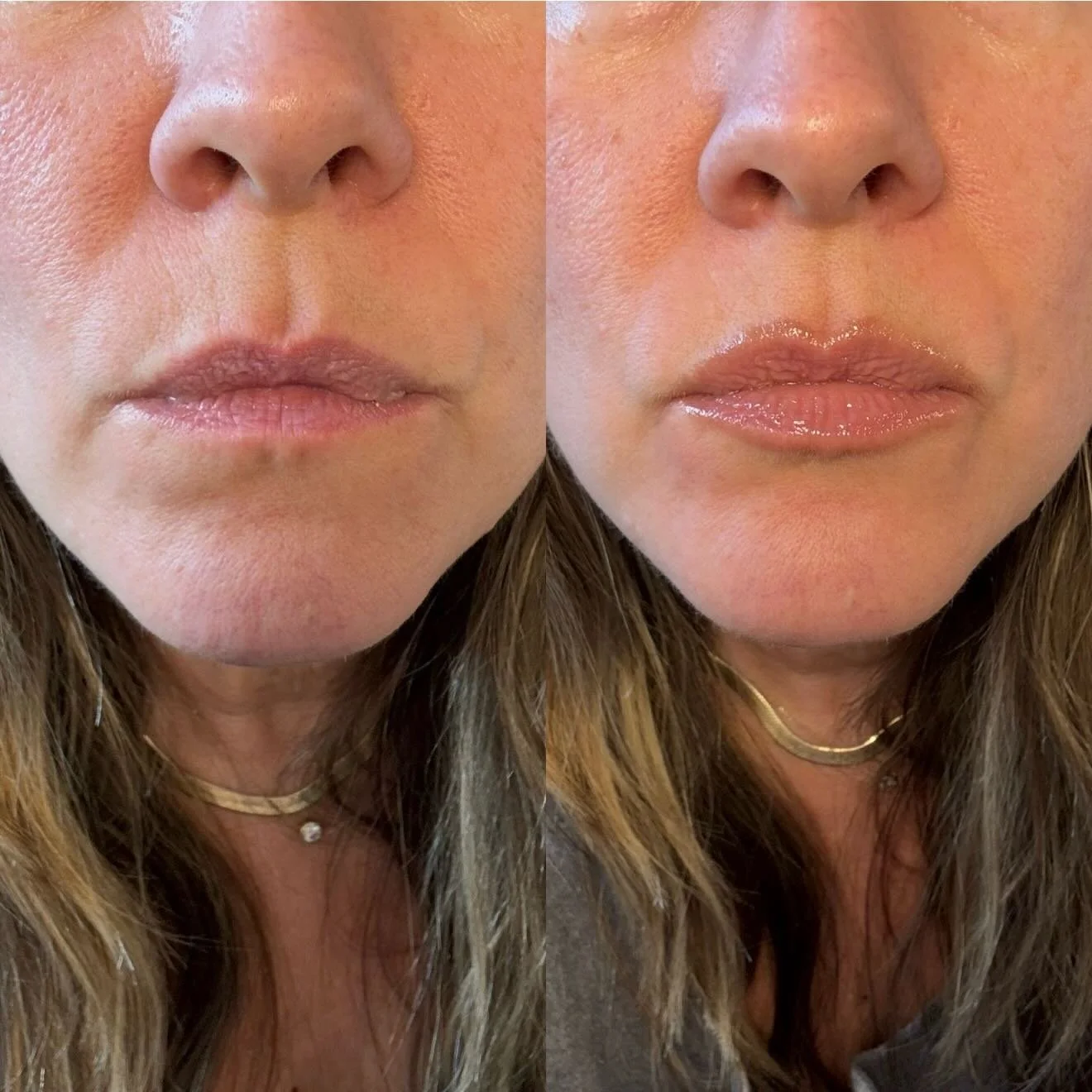 This is, simply put, the best lip liner we&rsquo;ve ever used. This is the exact same spot, seconds apart. Never orange, sort of sheer, and makes us look like we got filler. We&rsquo;ve been writing about this lip liner since we discovered it last ye