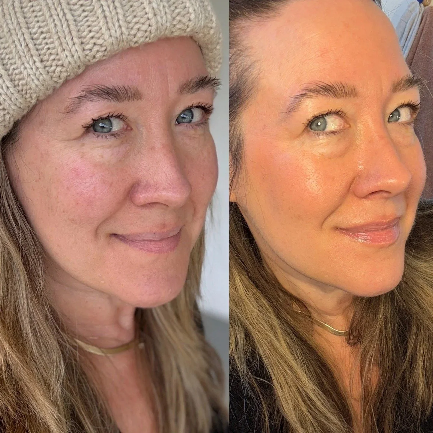 If you literally DESPISE the feeling of makeup on your skin (aka, even tinted moisturizers are too thick for you) but you also want even glowing skin that doesn&rsquo;t exacerbate fine lines, THIS IS THE POST FOR YOU. We found a sheer, no-makeup make