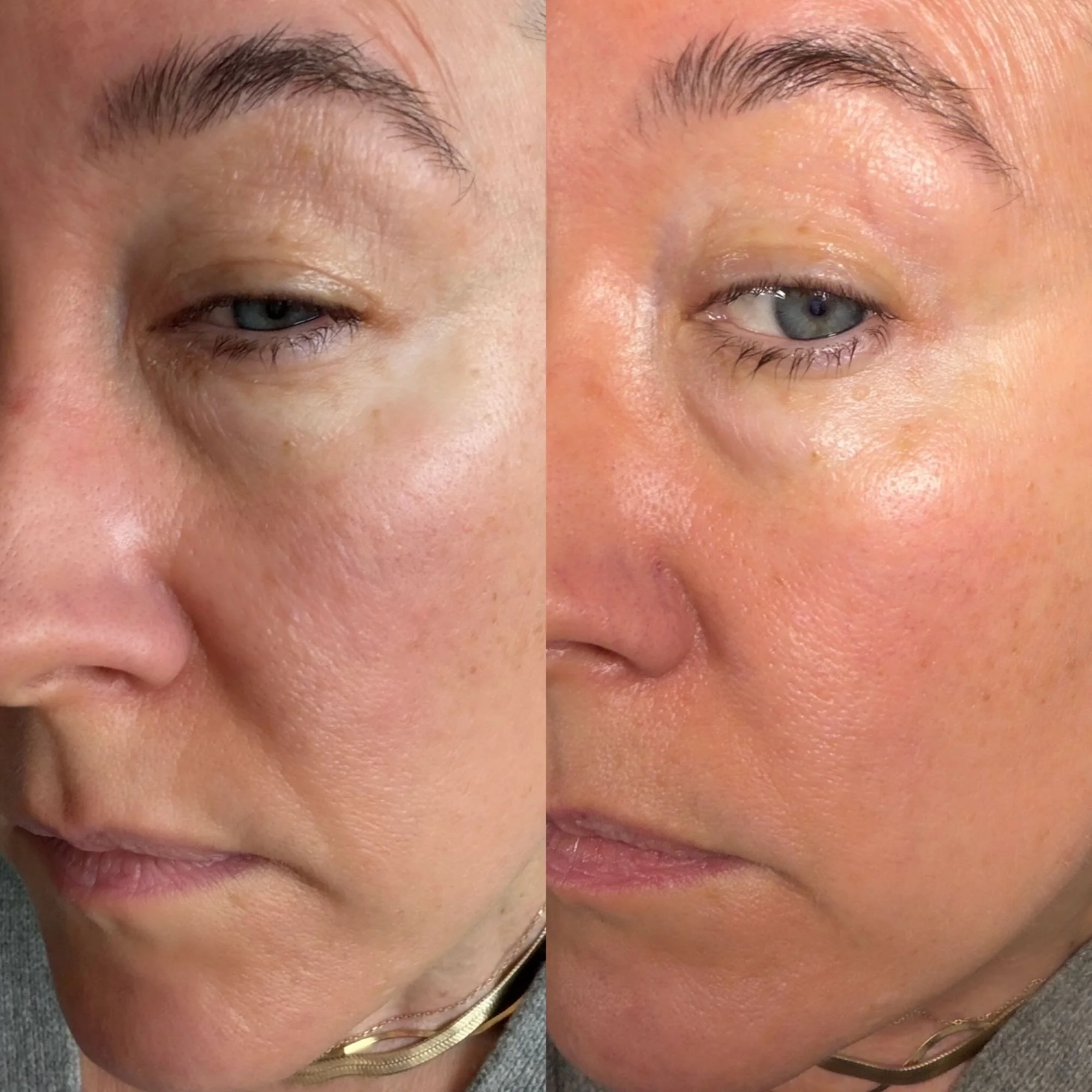 This Balm Is The Answer To Our Dry Skin And Crepey Eyelids