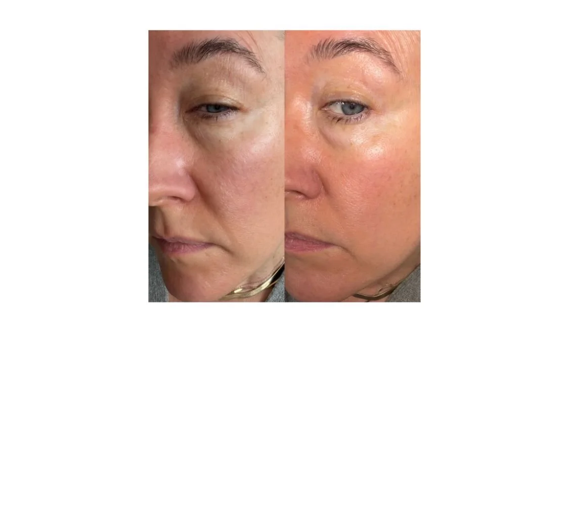 This Balm Is The Answer To Our Dry Skin And Crepey Eyelids